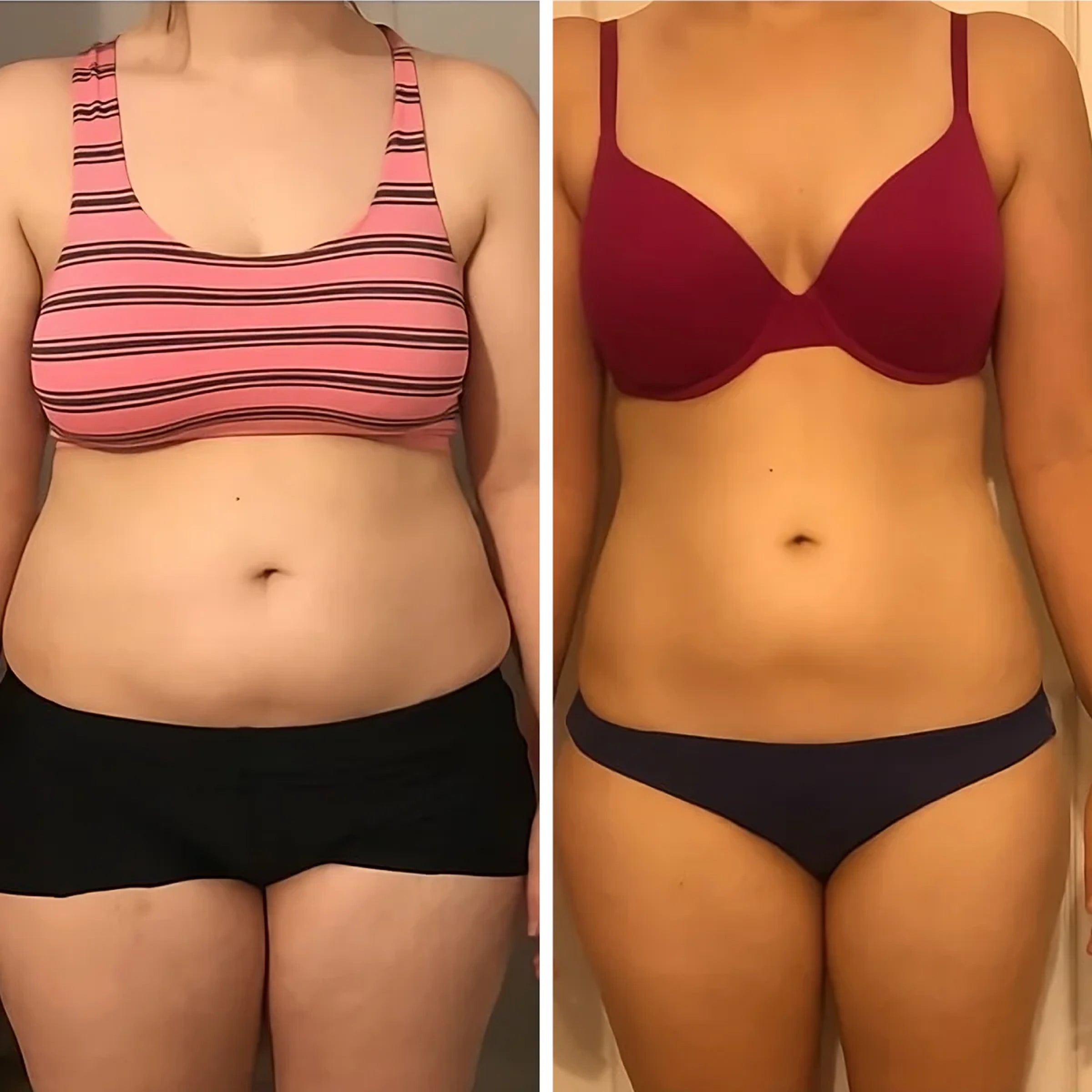 Antes y despues Lorena | Hot shapers Resultados antes y después de Hot Shapers mostrando figura más estilizada